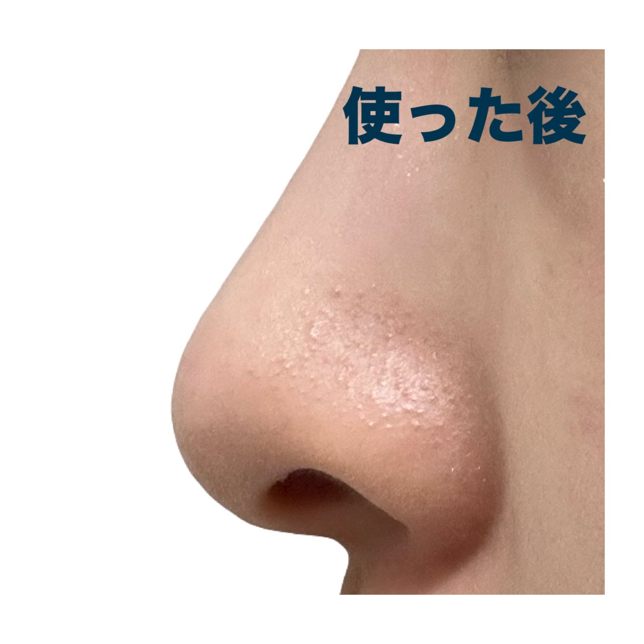 ノーズピーリングパック/One-day's you/シートマスク・パックを使ったクチコミ(5枚目)