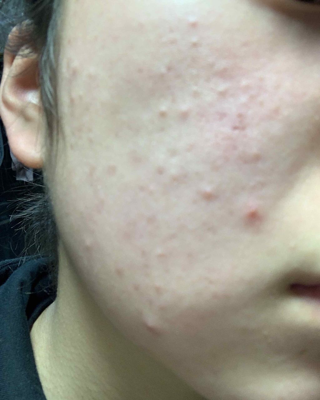 もも on LIPS 「初投稿です。画像注意です⚠️気分を悪くされた方ごめんなさい🙇..」(4枚目)