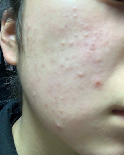 もも on LIPS 「初投稿です。画像注意です⚠️気分を悪くされた方ごめんなさい🙇..」(4枚目)