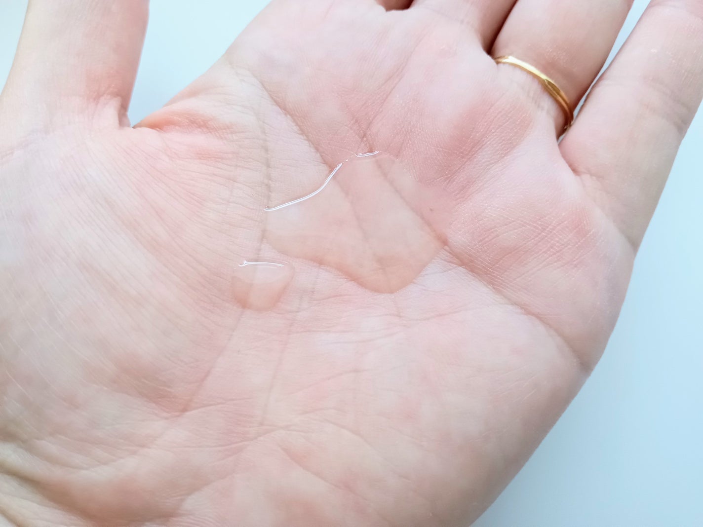 ビタプル リペア エッセンスローション/VITAPURU/化粧水を使ったクチコミ(4枚目)