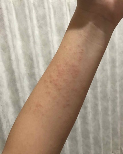 スキンガーデン アロエベラ98% モイスチャージェルのクチコミ「初投稿になります!拙い文章ご了承ください🙏🏻
2枚目の画像はベビーパウダーとの大きさの比較です.....」(3枚目)