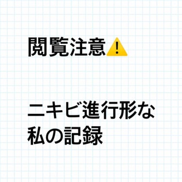 ニキビに悩むアラサー女子です😭

自分の記録用も兼ねて同じような悩みがある方
の参考になればと思い投稿します🙇‍♀️💦

✩ ⋆ ✩ ⋆ ✩ ⋆ ✩ ⋆ ✩﻿ ⋆ ✩ ⋆ ✩﻿
事の経緯は
地元から他県