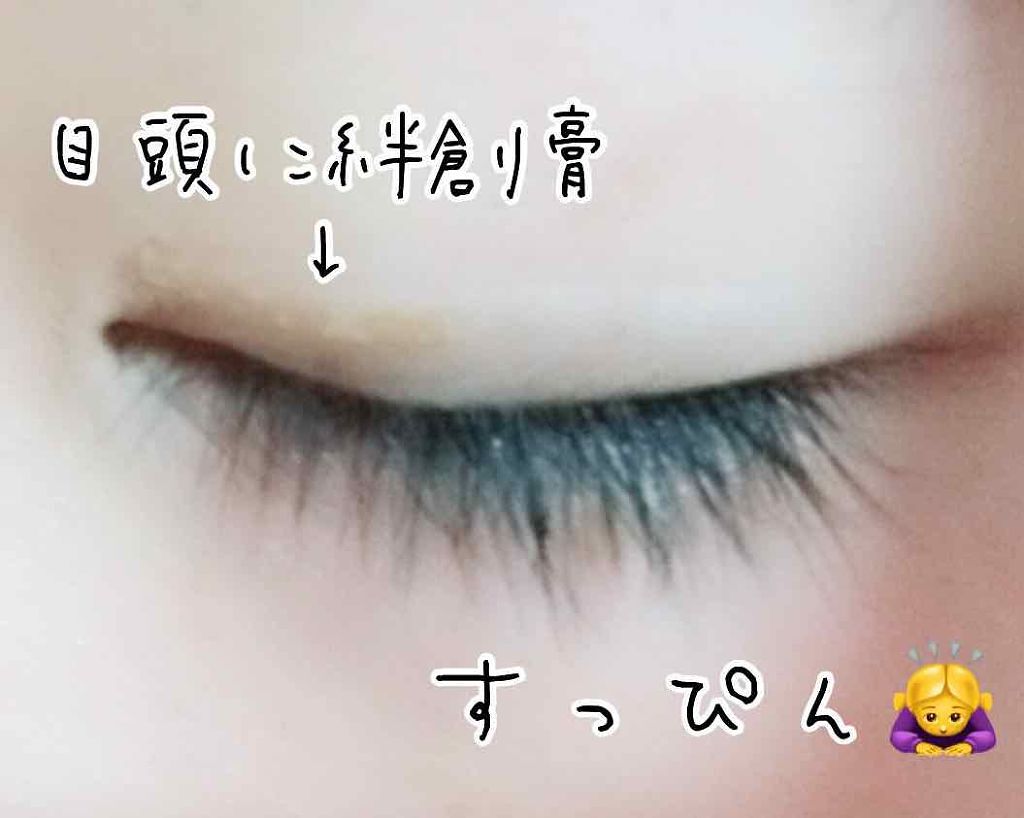 い と ✩*.゚ on LIPS 「⚠︎目ん玉あります⚠︎末広二重から平行二重に\\٩('ω')و..」(3枚目)