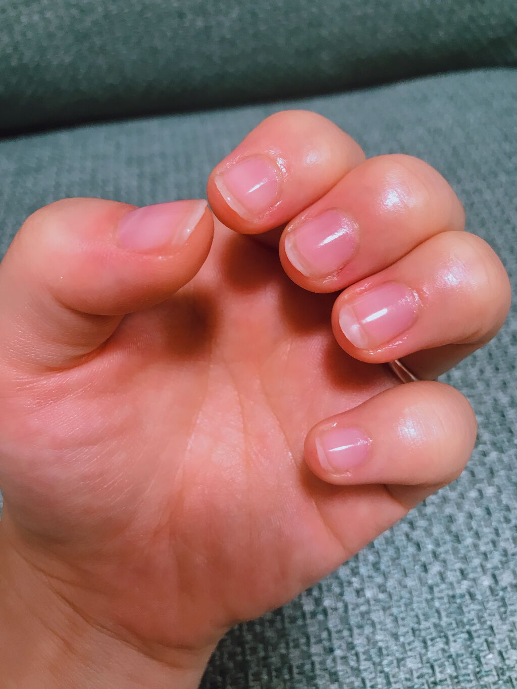 やんちー on LIPS 「記録です。右手は1度もむしった記憶はないけれど、相変わらずの汚..」(2枚目)