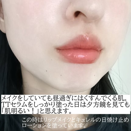 TTトラネキサム酸10%美容液/コスデバハ/美容液を使ったクチコミ(4枚目)