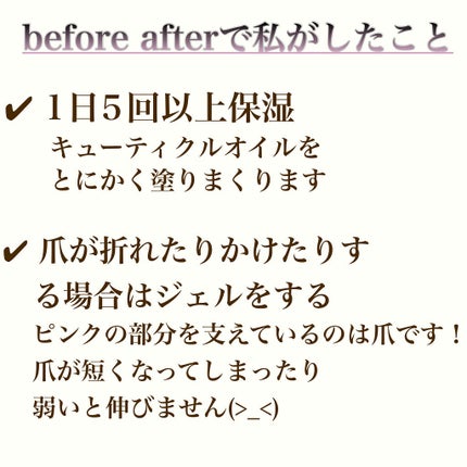 キューティクルオイル/ネイルホリック/ネイルオイル・トリートメントを使ったクチコミ(3枚目)