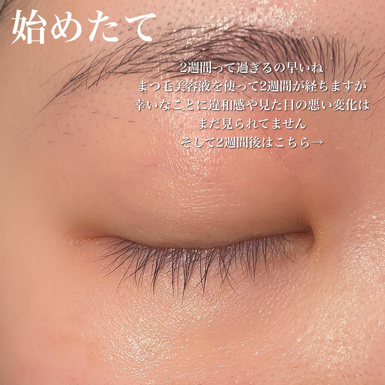 FEG  Eyelash  Enhancer/FEG/まつげ美容液を使ったクチコミ(2枚目)
