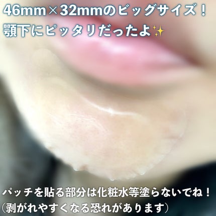 ゼロスポットパッチ/Today’s Cosme/にきびパッチを使ったクチコミ(4枚目)