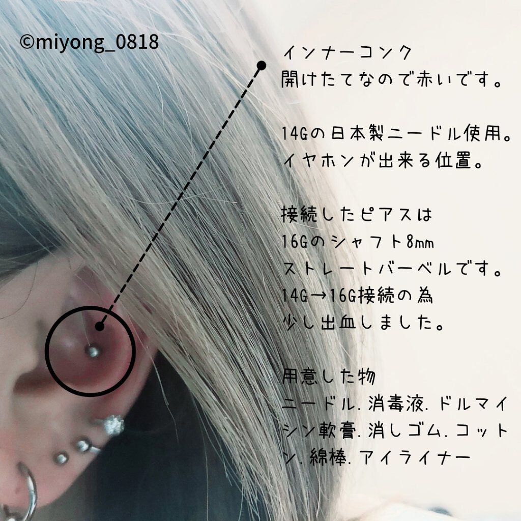 ドルマイシン軟膏(医薬品)/ゼリア新薬工業/その他を使ったクチコミ(2枚目)