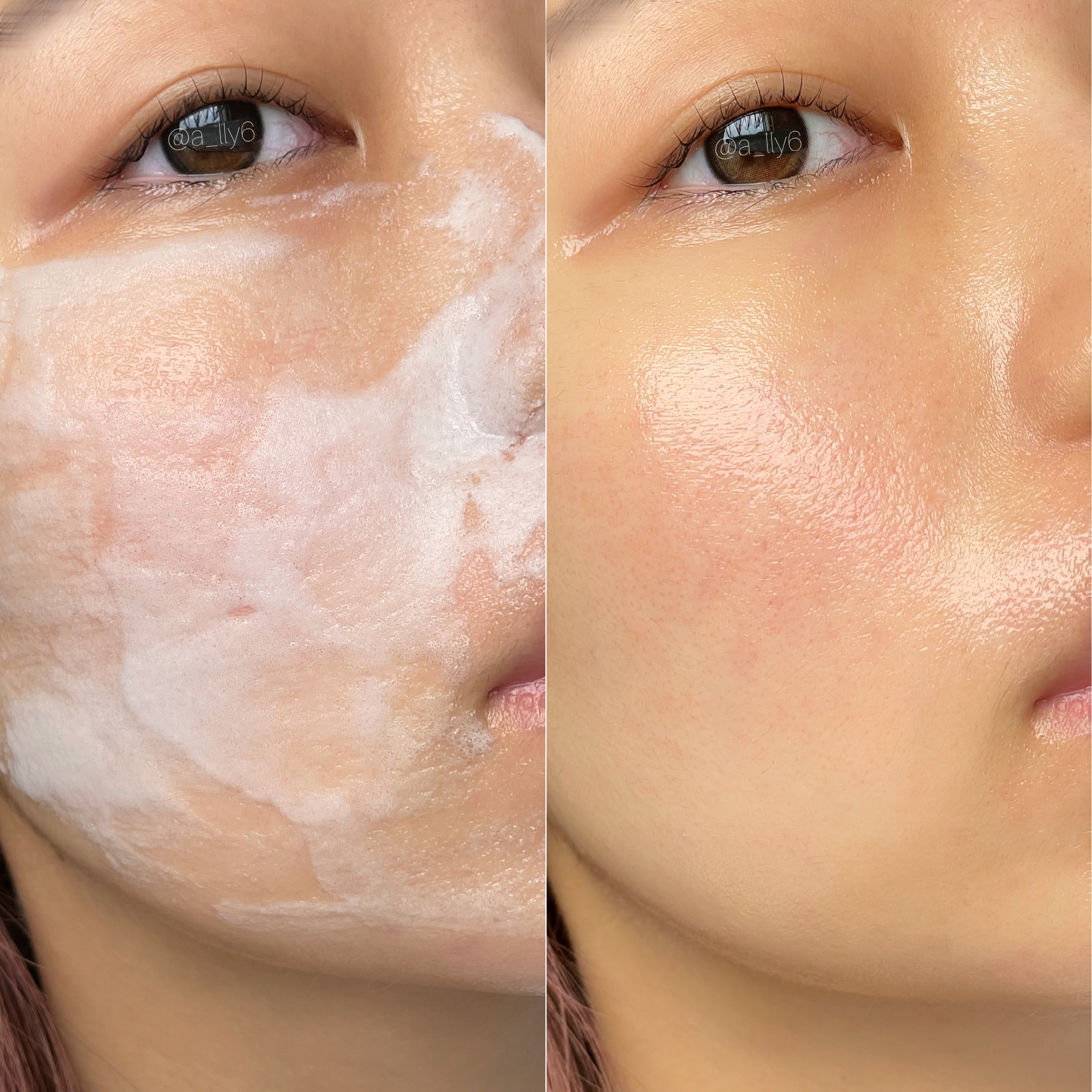 ペプチド ボリューム マスター エッセンス/DR.PEPTI/美容液を使ったクチコミ（3枚目）