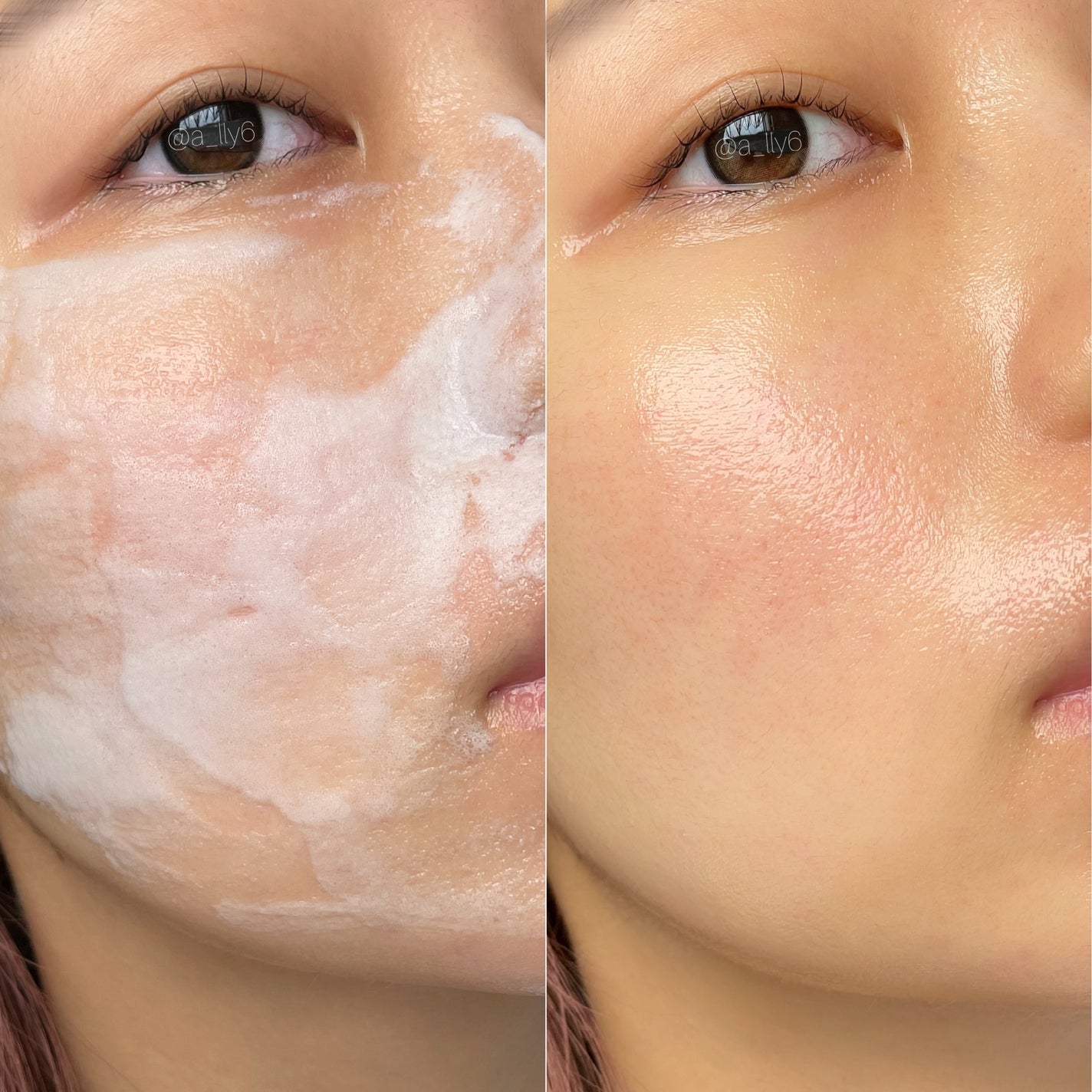 ペプチド ボリューム マスター エッセンス/DR.PEPTI/美容液を使ったクチコミ(3枚目)