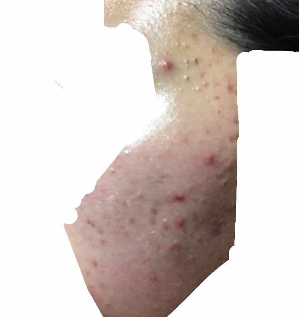 Gローション/HABA/化粧水を使ったクチコミ（2枚目）