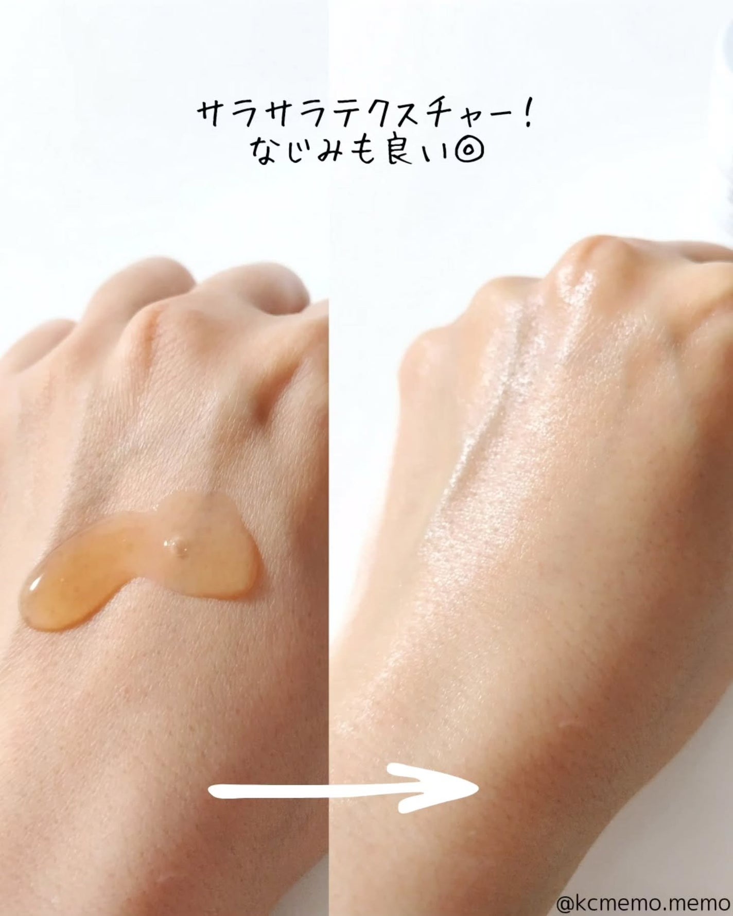 RXザ・アルファアルブチン2 ニキビ跡ケアセラム/COSRX/美容液を使ったクチコミ(4枚目)