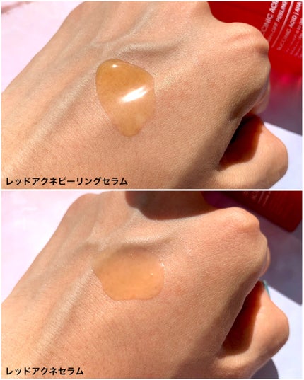 レッドアクネピーリングセラム/MEDICUBE/美容液を使ったクチコミ(8枚目)