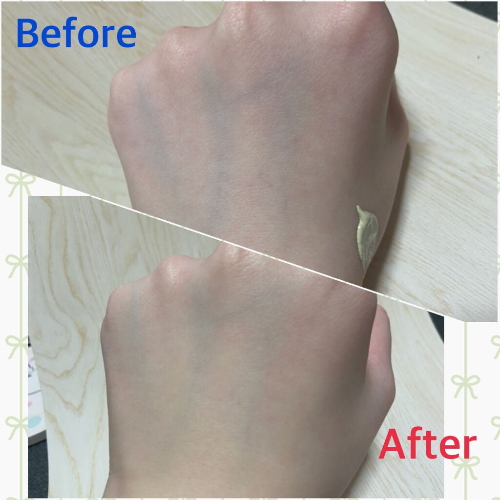 ドクタージャルト シカペア リカバー (第2世代)/Dr.Jart+/フェイスクリームを使ったクチコミ(3枚目)