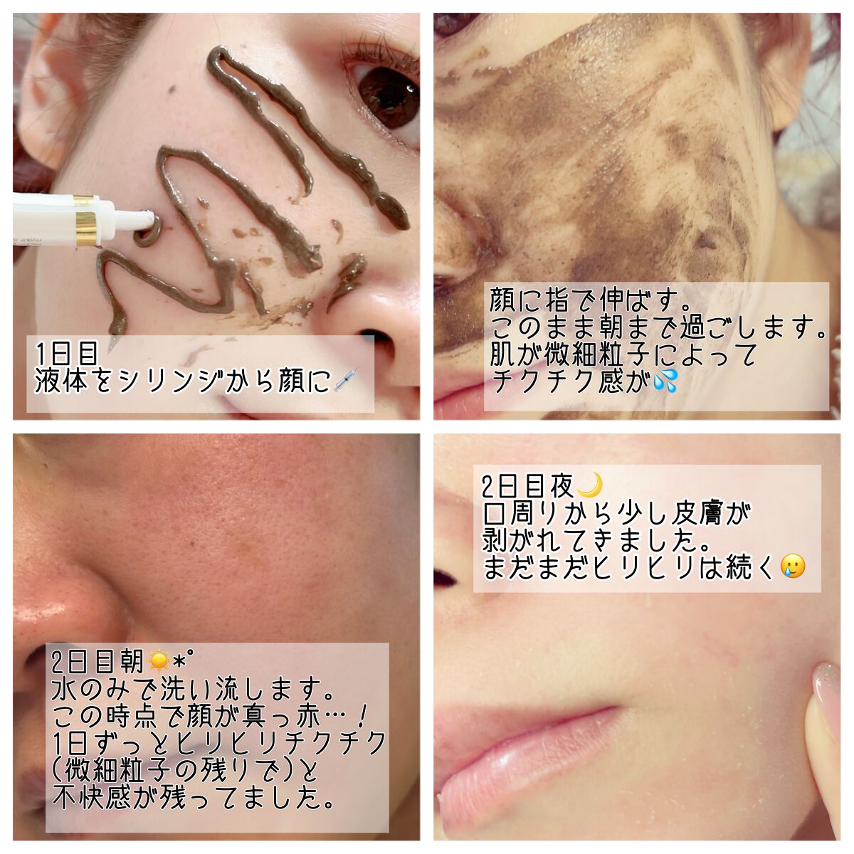 ダーマスキンピーリング｜BQCELLの効果に関する口コミ