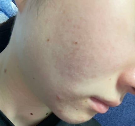 ソフティモ ディープ クレンジングオイル/ソフティモ/オイルクレンジングを使ったクチコミ(3枚目)