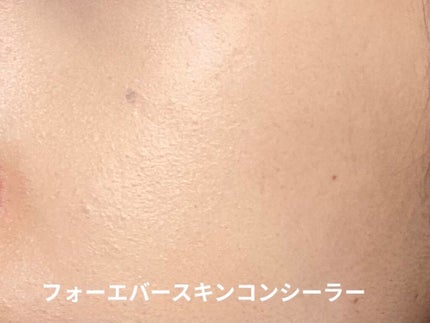 【旧】ディオールスキン フォーエヴァー スキン コレクト コンシーラー/Dior/リキッドコンシーラーを使ったクチコミ(6枚目)