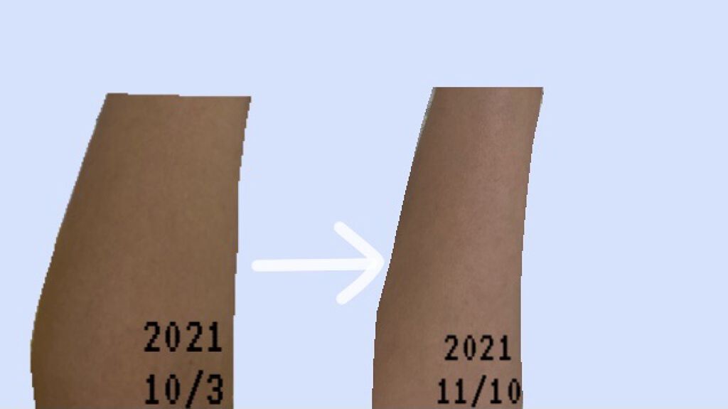 エバレッシュホワイトEXⅡ(医薬品)/matsukiyo/その他を使ったクチコミ（2枚目）