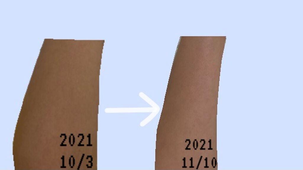 エバレッシュホワイトEXⅡ(医薬品)/matsukiyo/その他を使ったクチコミ(2枚目)