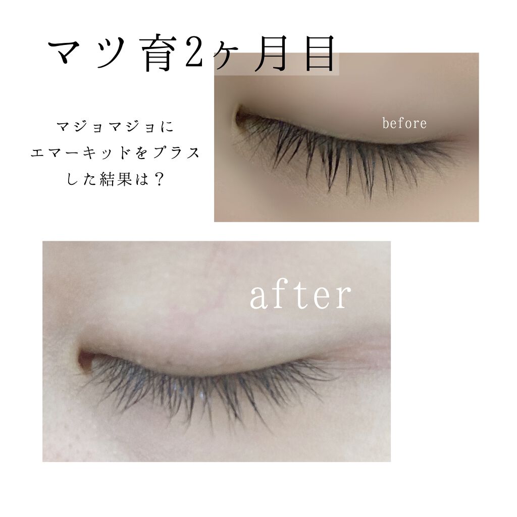 EMAKED(エマーキット)/水橋保寿堂製薬/まつげ美容液を使ったクチコミ(1枚目)