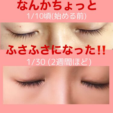 スカルプd ボーテ ピュアフリーアイラッシュセラム プレミアム アンファーの効果に関する口コミ まつげ のび 増えた スカルプdボーテ By Risa 乾燥肌 30代前半 Lips
