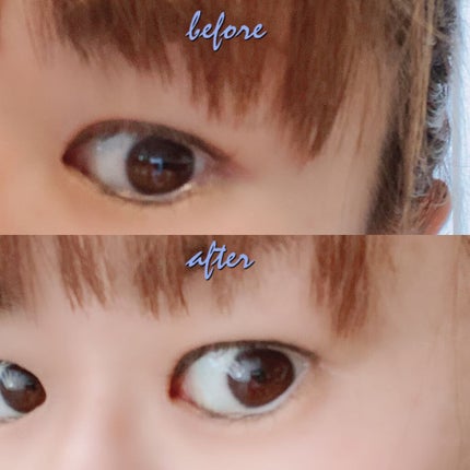 アイケアプロ/Le ment/美顔器・マッサージを使ったクチコミ(10枚目)