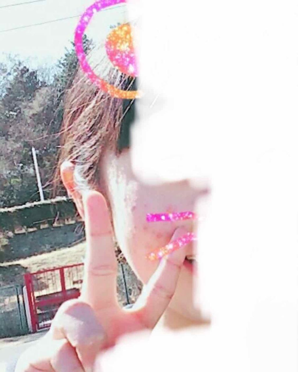 チョコラBBプラス (医薬品)/チョコラBB/その他を使ったクチコミ（1枚目）