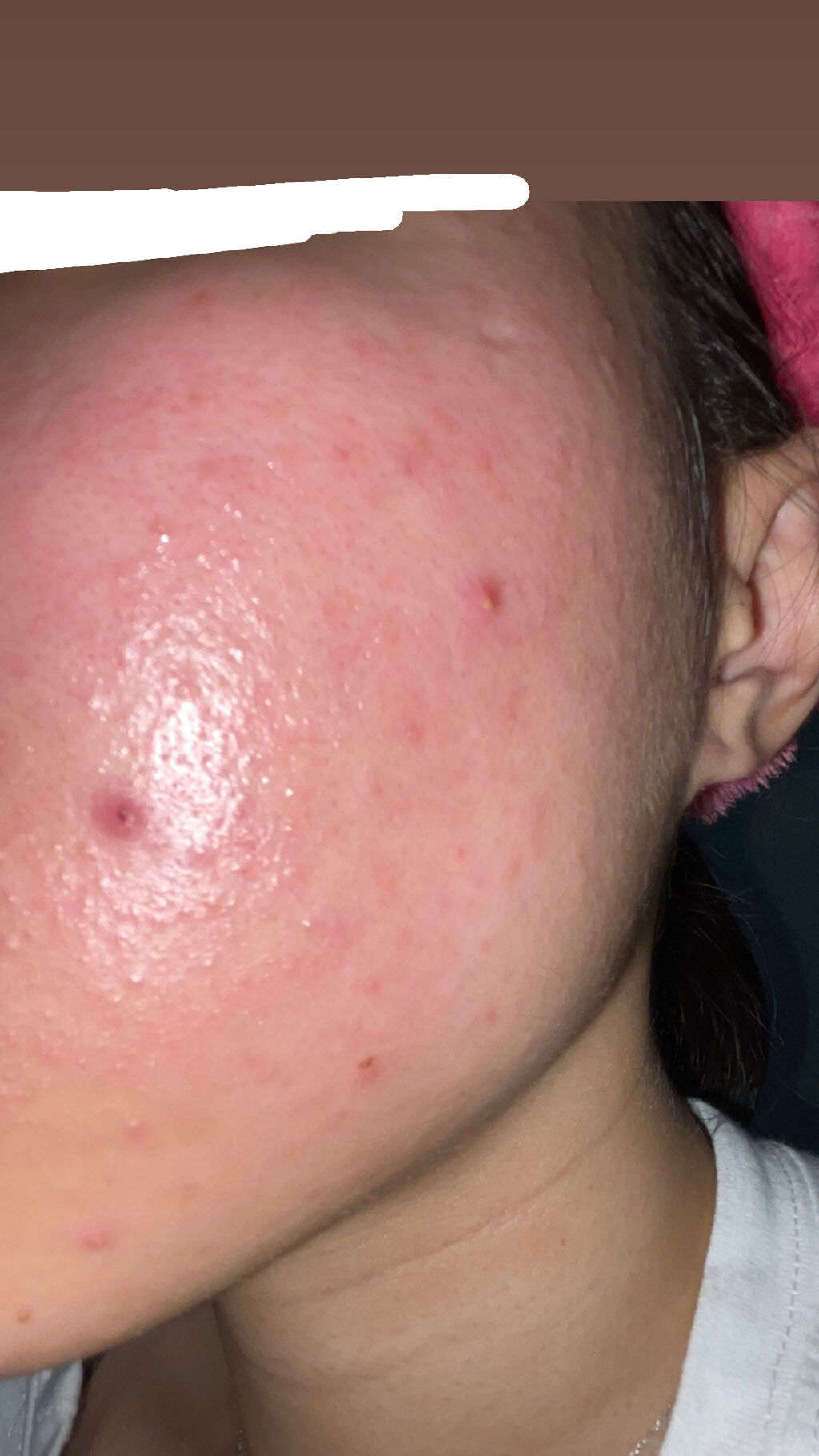 とろんと濃ジェル 薬用美白 N/なめらか本舗/オールインワン化粧品を使ったクチコミ（2枚目）