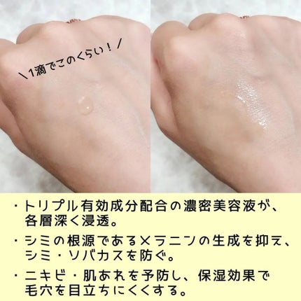 モイスチュアマイルドホワイトリペアエッセンス C100/モイスチュアマイルド ホワイト/美容液を使ったクチコミ(5枚目)