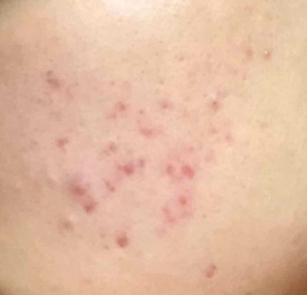 DHC はとむぎエキス/DHC/健康サプリメントを使ったクチコミ(2枚目)