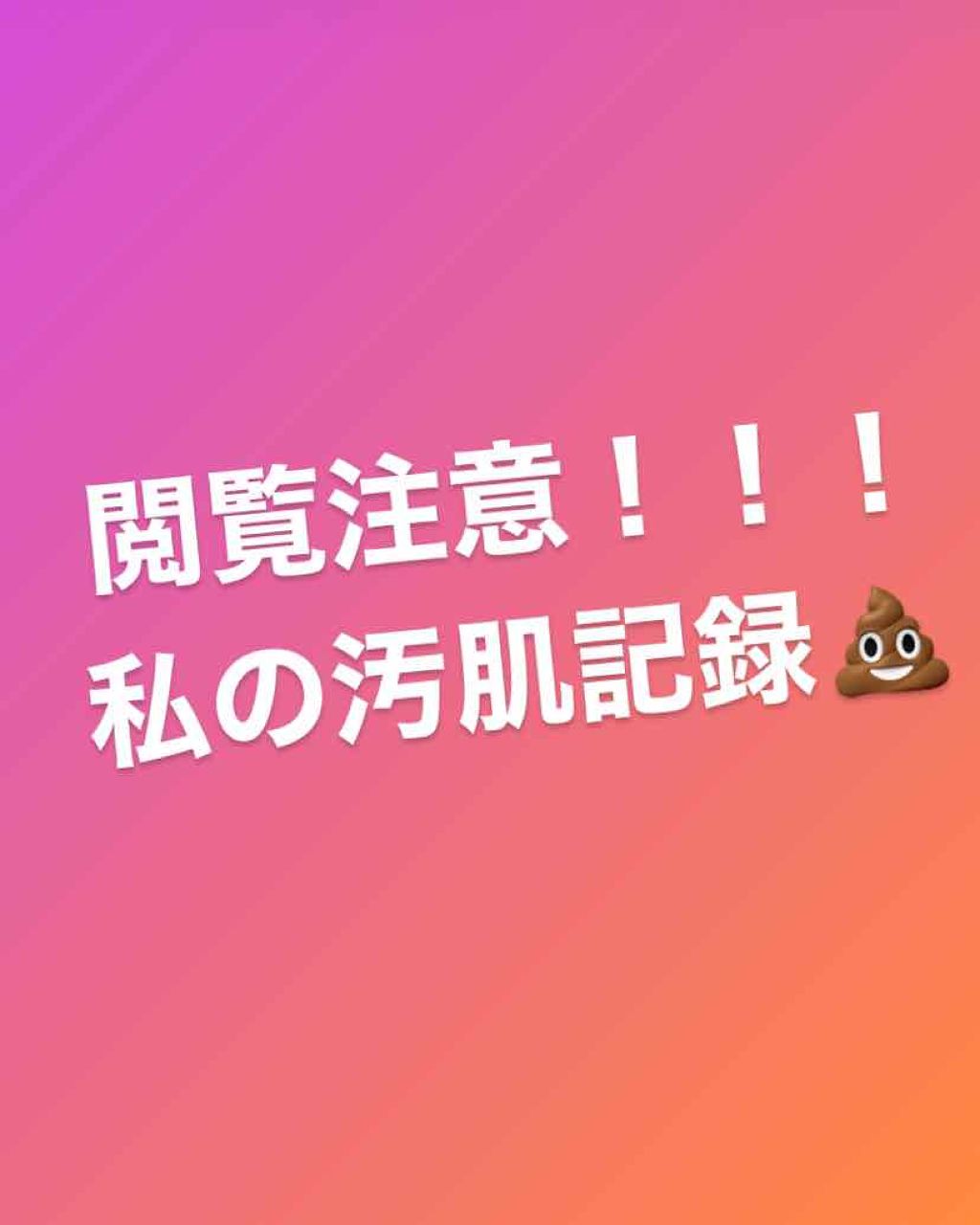 ノブ A アクネソープ/NOV/洗顔石鹸を使ったクチコミ(1枚目)