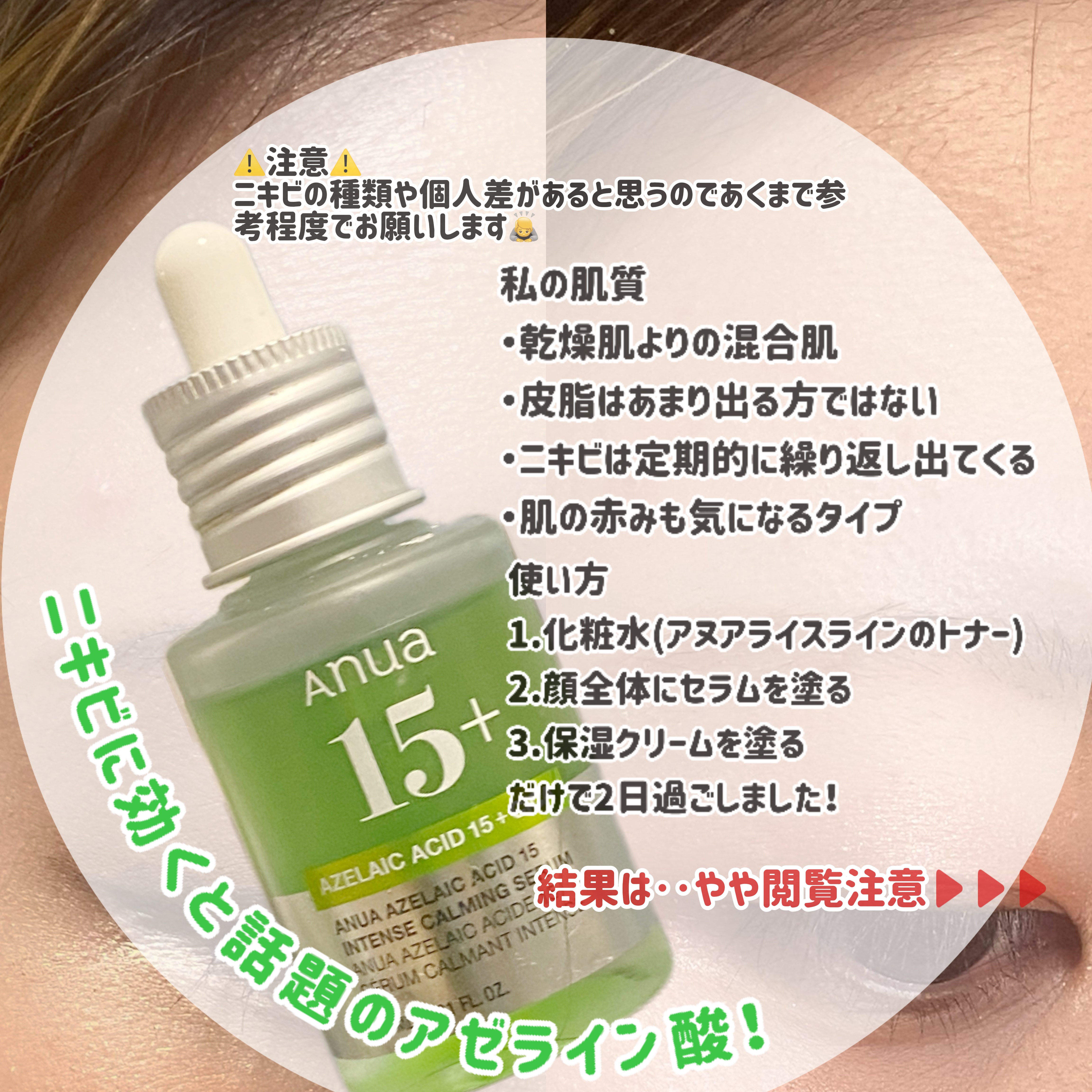 AZアゼライン酸10セラム/コスデバハ/美容液を使ったクチコミ（2枚目）