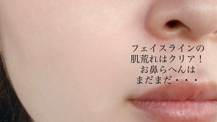 DHC ビタミンBミックス/DHC/美容サプリメントを使ったクチコミ(2枚目)