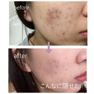 シンクロスキン セルフリフレッシング クッションコンパクト/SHISEIDO/クッションファンデーションを使ったクチコミ（1枚目）