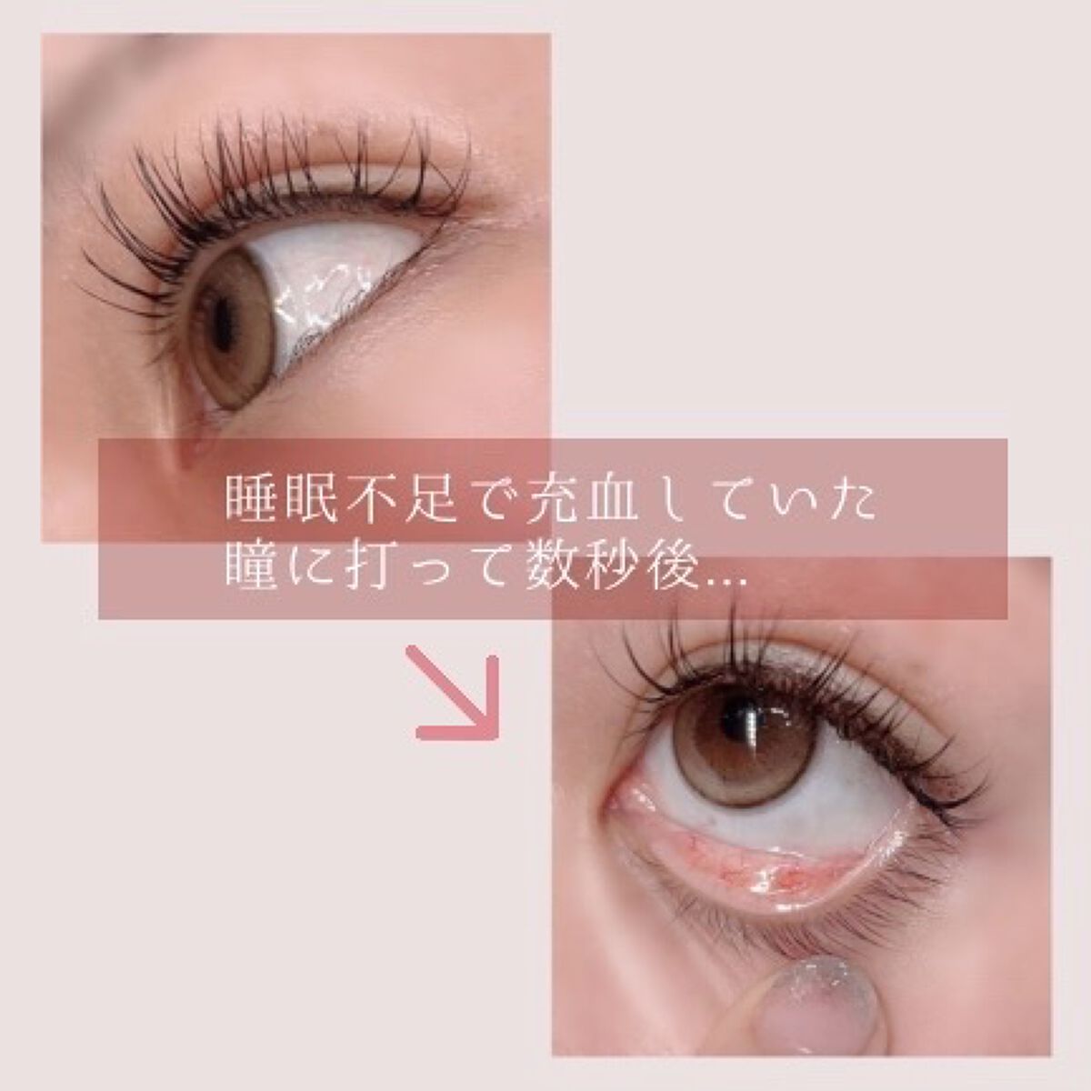 スマイルホワイティエ(医薬品)/ライオン/その他を使ったクチコミ（2枚目）