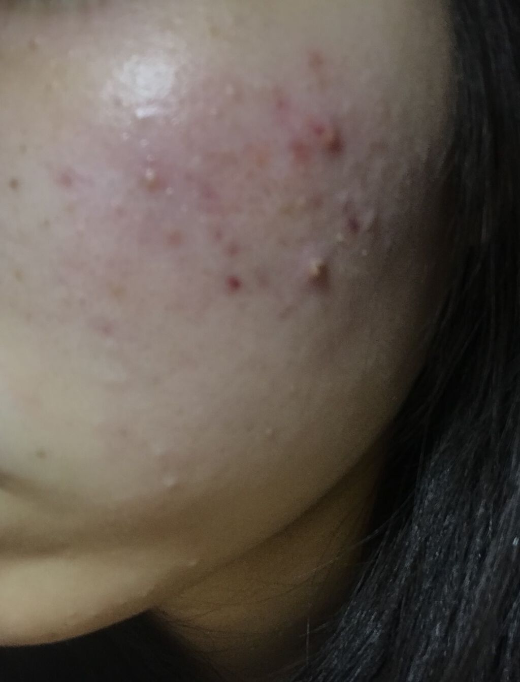 化粧水・敏感肌用・高保湿タイプ/無印良品/化粧水を使ったクチコミ（3枚目）