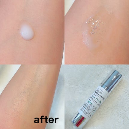 リードルショット300/VT/美容液を使ったクチコミ(2枚目)