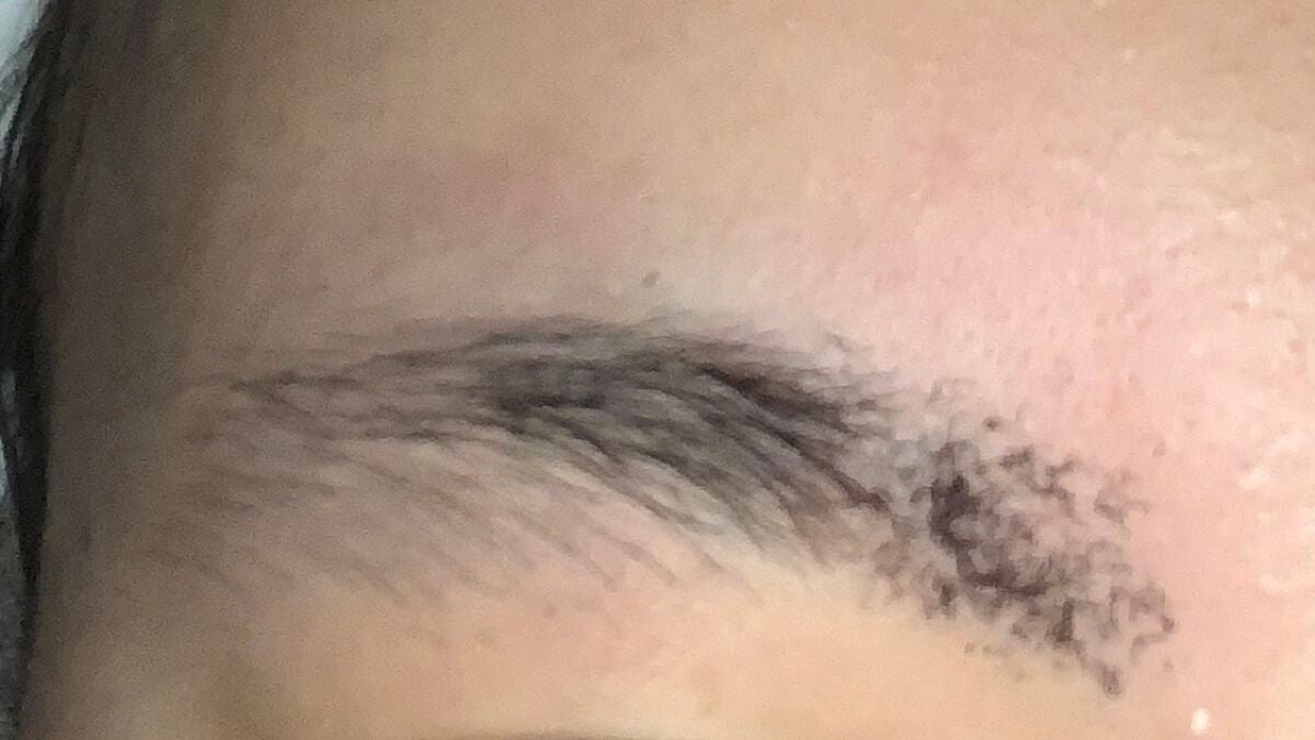 光美容器KE-NON(ケノン)/エムテック/家庭用脱毛器を使ったクチコミ(2枚目)