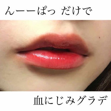 いくらちゃん on LIPS 「BbyBANILA(ビーバイバニラ)のシュガーコートグローティ..」（1枚目）