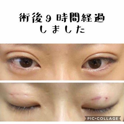 を使ったクチコミ(1枚目)