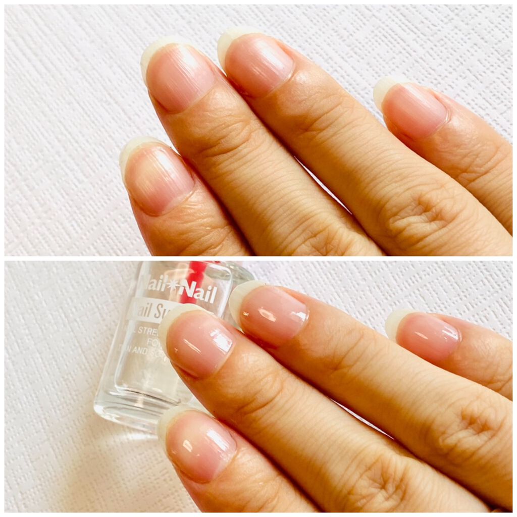 ネイルサポート Na ネイルネイルの口コミ 骨折した影響か爪がバキバキに割れたり欠けた By Minori 乾燥肌 30代前半 Lips