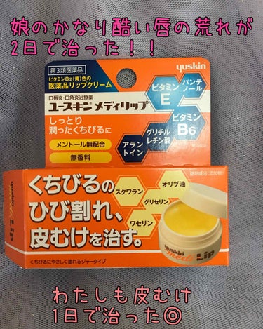 メディリップ（医薬品）/ユースキン/その他を使ったクチコミ（1枚目）