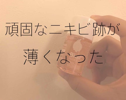 バイオイル/バイオイル/フェイスオイルを使ったクチコミ(1枚目)