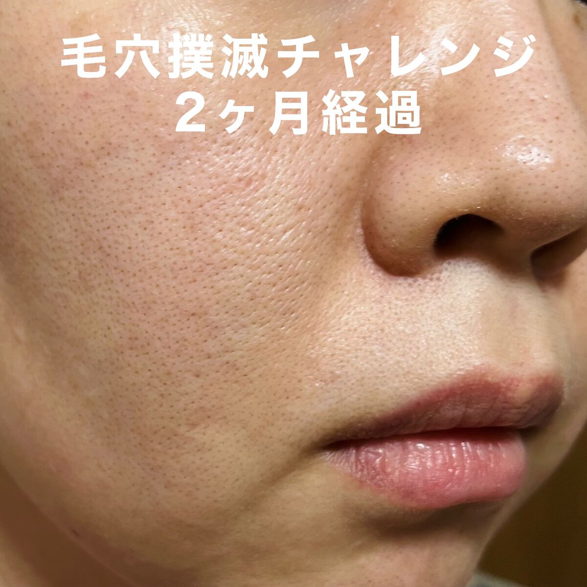 N10+Z1フェイスセラム /The Ordinary/美容液を使ったクチコミ（1枚目）