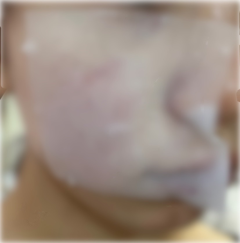 ウォンジョンヨ  モイストアップレディスキンパック DM N/Wonjungyo/シートマスク・パックを使ったクチコミ（2枚目）