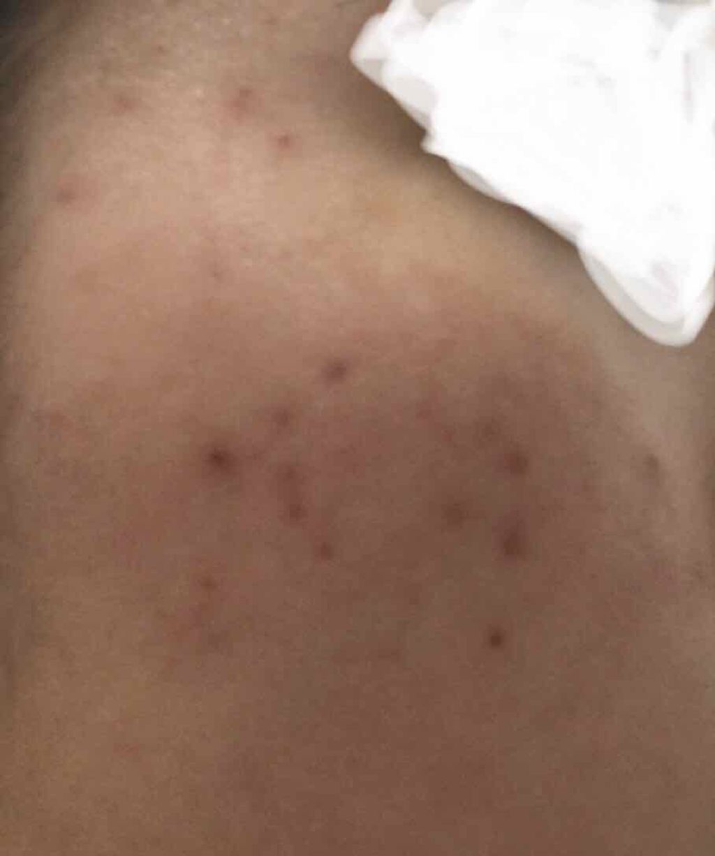 ハトムギ保湿ジェル(ナチュリエ スキンコンディショニングジェル)/ナチュリエ/美容液を使ったクチコミ(3枚目)