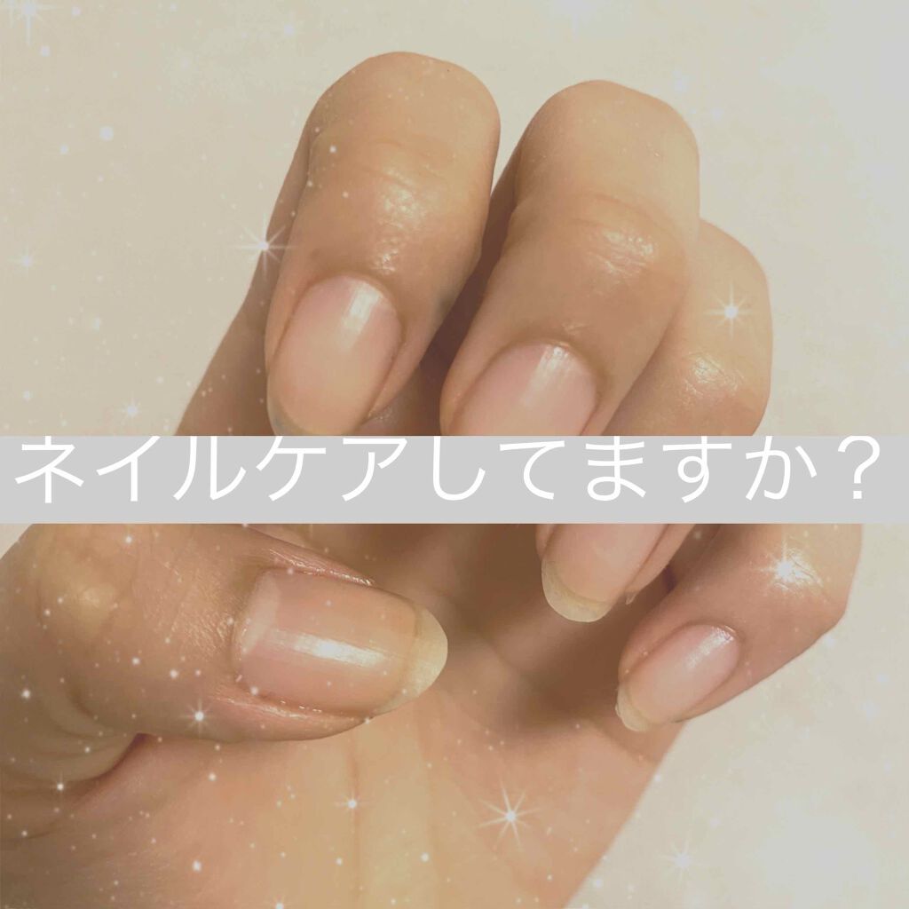 キューティクルリムーブオイル N/ネイルネイル/ネイルオイル・トリートメントを使ったクチコミ(1枚目)