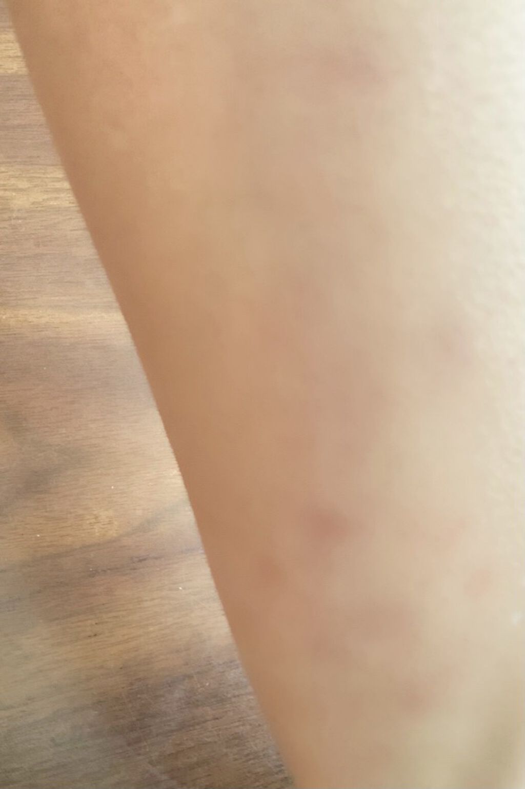 スリミティ ローラー(ボディ用・ビッグ)/セリア/ボディローラーを使ったクチコミ（3枚目）