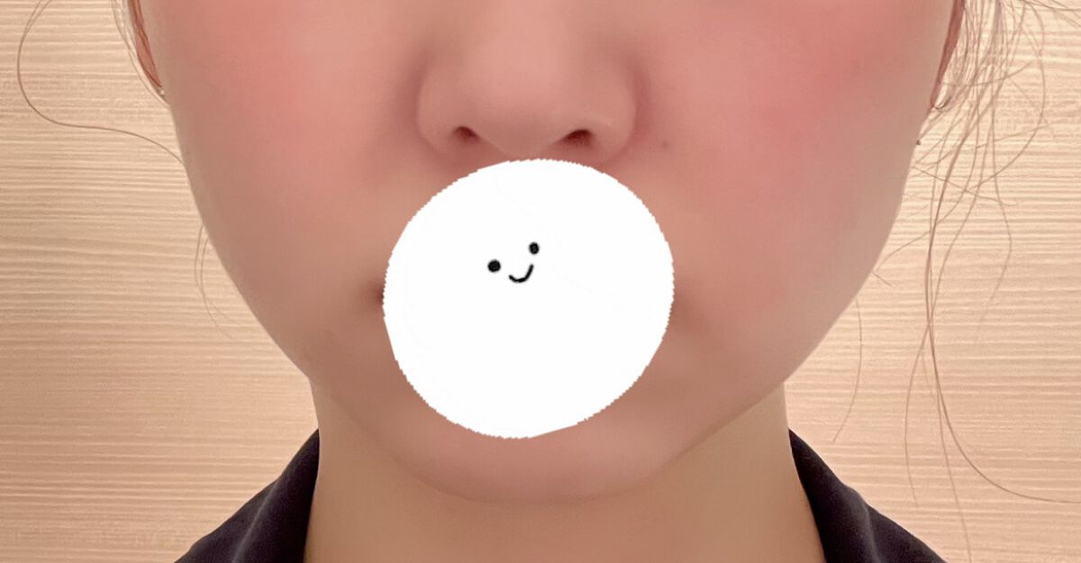 スカルプリフト アクティブ プラス/mysé(ミーゼ)/美顔器・マッサージを使ったクチコミ（2枚目）